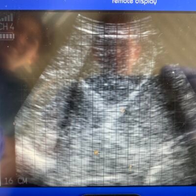 dilated gut loops dilated gut loops Devon Dairy Farm Vets